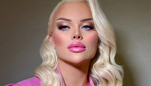 6 mesiacov sa skrývala, teraz je naspäť: Prvá česká Barbie šokovala premenou