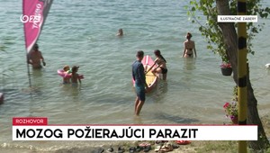 Rozhovory 24: Mozog požierajúci parazit