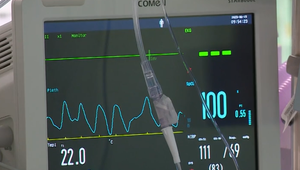 Na orgány čakajú pacienti roky. Chystajú zmenu v legislatíve