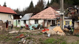 Mumps sa šíri osadou. Obyvatelia nedodržiavajú príkazy