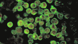 Smrtiaca améba u 11-ročného chlapca: Pôvod nákazy je stále neznámy