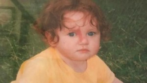 Narodila sa s veľkým fľakom na tvári, dnes je ešte výraznejší: Takto vyzerá mladá žena teraz