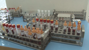 Záhadná Q horúčka v okrese Prievidza ustúpila. Zdroj nákazy zostáva neznámy