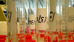 Lekár oplodňoval ženy vlastnými spermiami