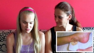 Žilinská nemocnica pochybila pri liečení Natálky (13)!