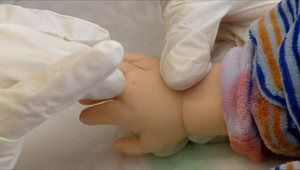 Osýpky na východe pretrvávajú. Zdravotníci evidujú 249 prípadov, epidémia pokračuje