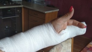 Každá bolesť ruky nie je syndróm karpálneho tunela! Takto ju odlíšite