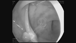 Vedci: Táto strava chráni až pred 5 druhmi rakovín, ale nie je bez rizika