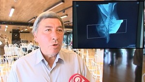 Rakovina prsníka trápi aj našich mužov. Jozef o tom vie svoje...