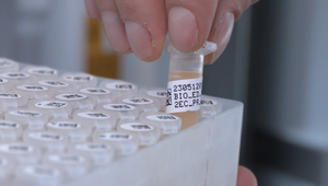 Aké tajomstvá skrýva DNA Slovákov? Výskum prinesie nové poznatky o našom zdraví