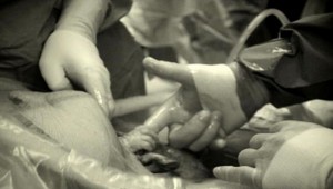 Neuveriteľná fotografia. Nenarodené bábätko chytilo lekára...