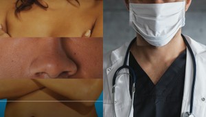 Sú chĺpky na INTÍMNYCH partiách v poriadku? Lekári VARUJÚ: Dávajte si pozor na TOTO!