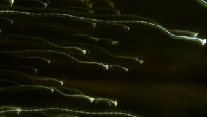 Prečo spermie plávajú spolu? Za víťazstvom jednej z nich je tímová práca!