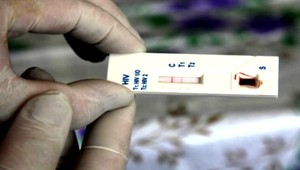 Počet nakazených HIV na Slovensku stúpa. Vyliečiť sa môžu špeciálnym génom