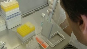 V Británii vyliečili muža z HIV