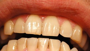 Bizardné právo - zákaz skonu v parlamente