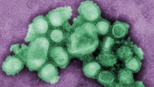 Prasacia chrípka je ľudským vírusom, neprenášajú ju prasatá