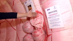 Kolonoskopia môže byť aj bezbolestná, poisťovne ju však pacientom neuhradia