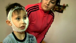 Na Mateja (9) zaútočil túlavý pes! Roztrhal mu tvár...