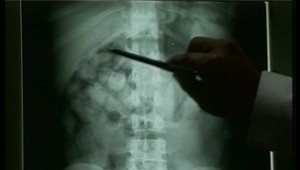 Nigérijčan s drogami v bruchu čelí doživotiu