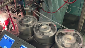 Revolúcia v medicíne: Prvá 3D operácia srdca na Slovensku