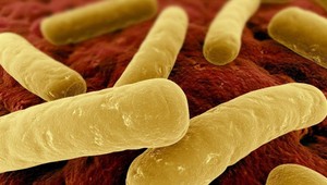 Zákerný botulotoxín: Otrava jedom sa prejaví do 36 hodín