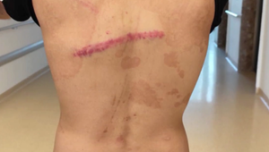 Muž tvrdí, že ho na policajnej stanici zbili teleskopickým obuškom