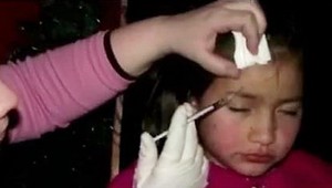 Šialená matka. Priznala, že dievčatku (8) pichá botox!