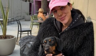 Najprv plastika nosa, teraz TOTO? Bianka Rumanová opäť šokuje fanúšikov!