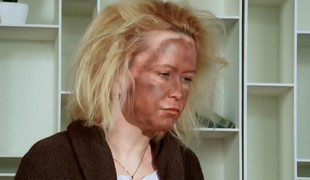 Herečka experimentovala so samoopaľovacím krémom! Pozrite sa, ako to dopadlo