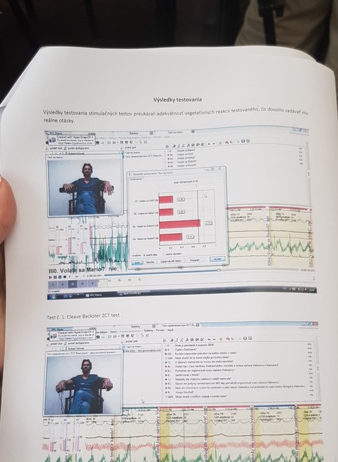 Kaliňák na detektore