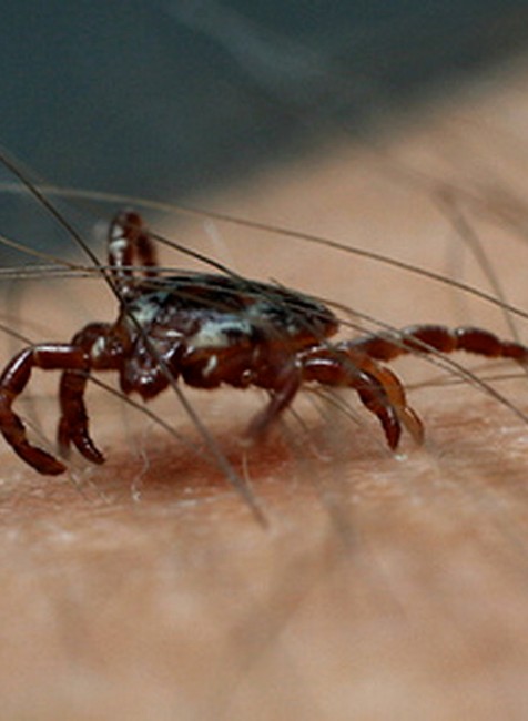 Kliešť na pokožke zblízka