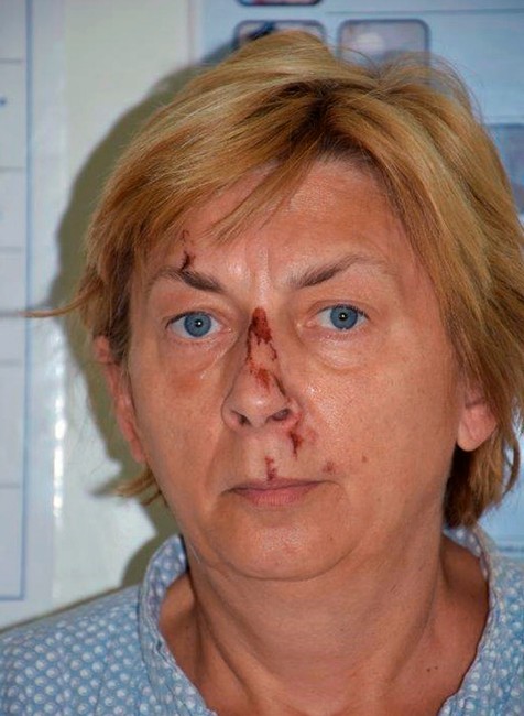 Chorvátsko - Ženu so stratou pamäte identifikovali ako Slovenku