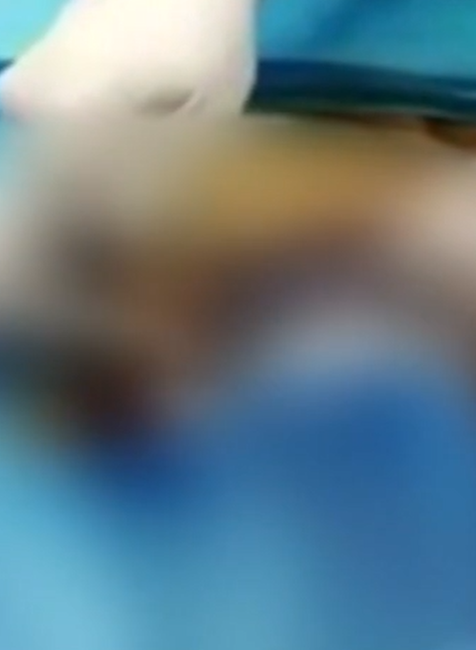 falosny plasticky chirurg 1