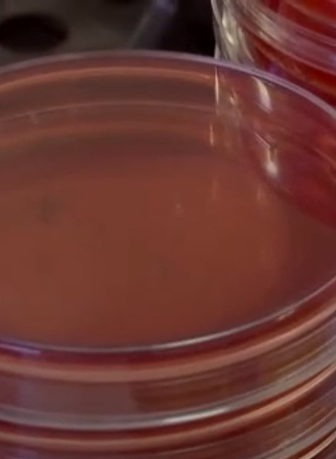 Fullscreen capture 2812201Pacienti si počkajú na diagnostiku. Nemocnice rušia niektoré oddelenia8 182010