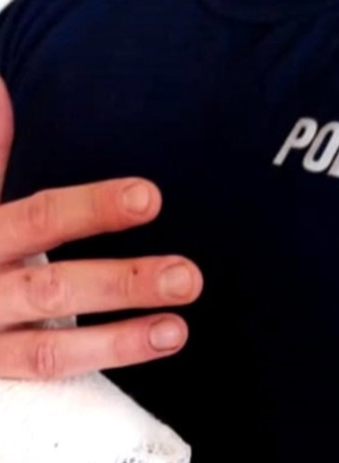 Pri zatýkaní hrýzol.