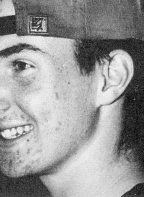 Spevák Adam Levine mal ako tínedžer veľké problémy s akné, no tieto problémy odišli spolu s pubertou 