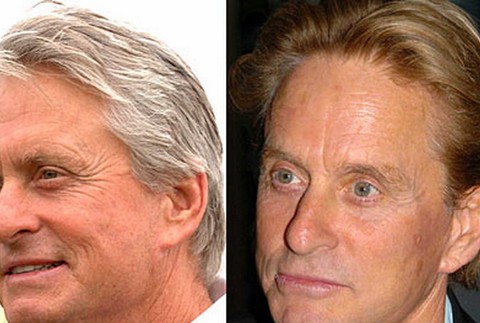 Michael Douglas plastika