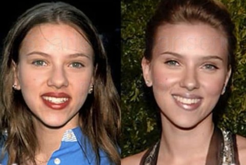 Scarlett Johansson má operovaný nos