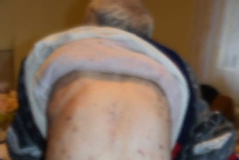 Hyenizmus v jednom z domovoch sociálnych služieb.