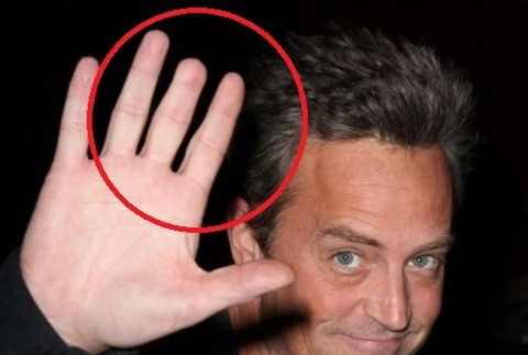 Matthew Perry známy ako Chandler Bing zo seriálu Priatelia, stratil časť prsta pri nehode v mladosti...
