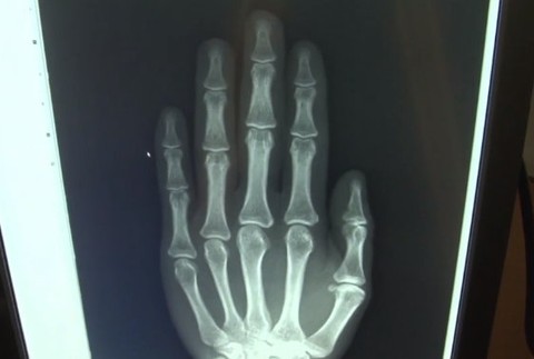 Kontroly malých migrantov