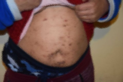 Hyenizmus v jednom z domovoch sociálnych služieb.