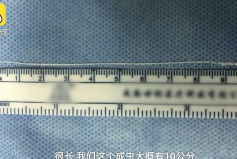 Červ v mozgu Číňana