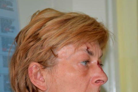 Chorvátsko - Ženu so stratou pamäte identifikovali ako Slovenku