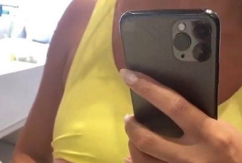 Chrissy Teigen jazvy po operácii