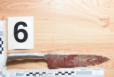 Hádka sa skončila brutálnym útokom. Vyšetrovateľ v prípade obvinil 27-ročného muža