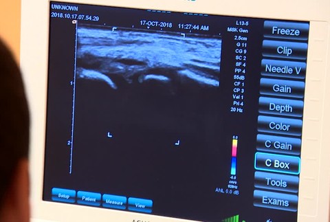 Sonograf po novom1387