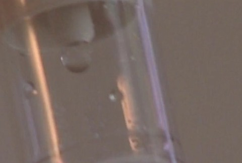 Inovatívna liečba rakoviny dostupná už aj na Slovensku. 