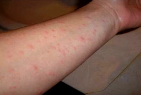 osypky pokračovanie645